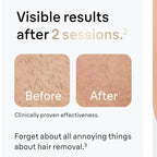 Zenvoria™ SilkPulse IPL Hair Removal Device