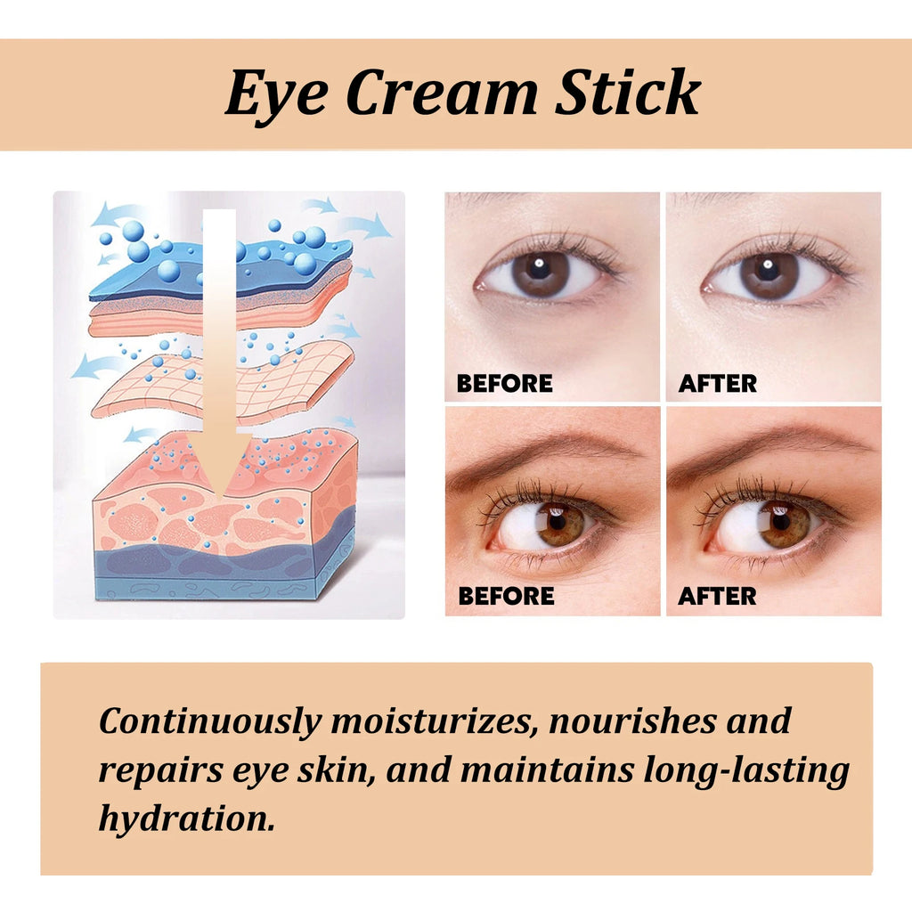 Hoygi Snail Peptide Eye Cream Stick – Dark Circle, Puffiness & Fine Line Care | Zenvoria