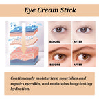 Hoygi Snail Peptide Eye Cream Stick – Dark Circle, Puffiness & Fine Line Care | Zenvoria